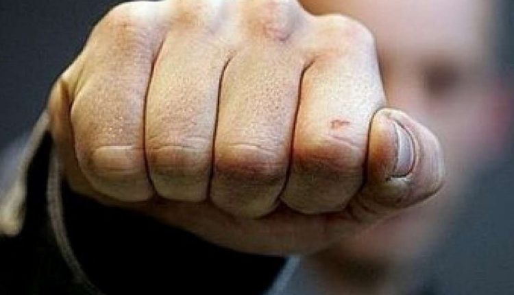 На Киевщине депутата избил почетный гражданин города