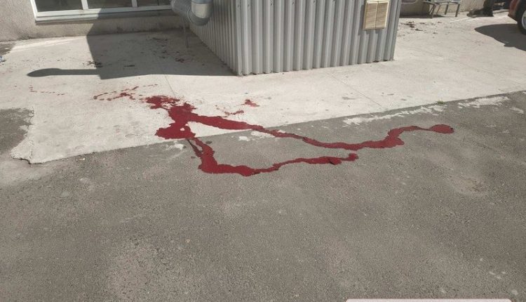 В Николаеве пулевое ранение в голову получил Михаил Титов, известный как «Мультик»